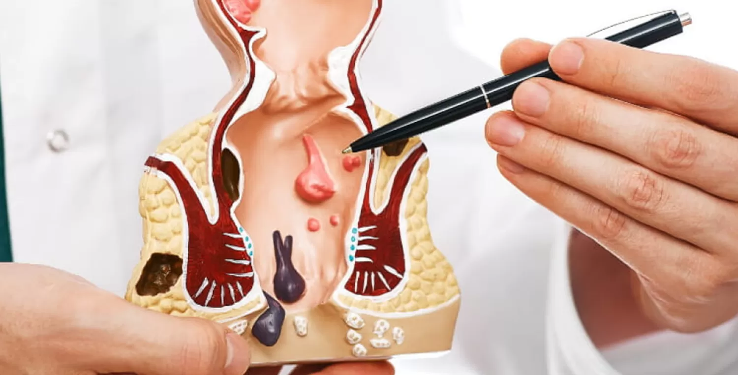 Anal Apse ve Peri Anal Apse